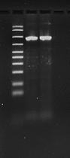 DNAの電気泳動写真