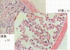 図2-2 産卵後(10月)のサザエの生殖腺組織像